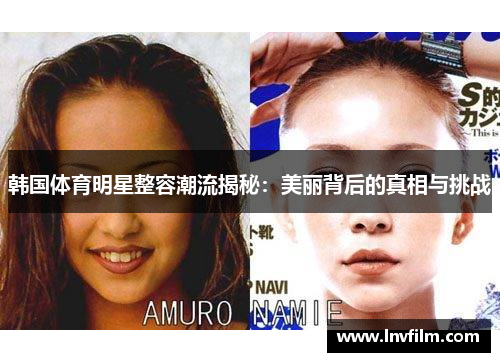 韩国体育明星整容潮流揭秘：美丽背后的真相与挑战